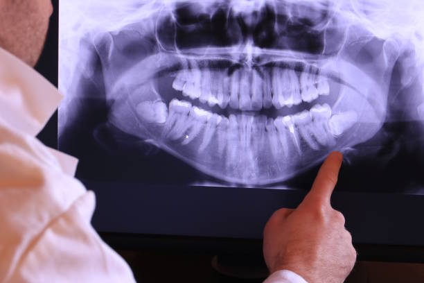 Best Emergency Dental Surgery in Fredonia, NY
