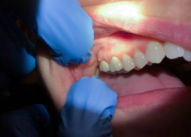 Best Pediatric Emergency Dentist in Fredonia, NY
