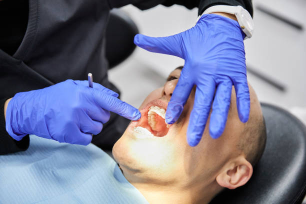 Best Weekend Emergency Dentist in Fredonia, NY